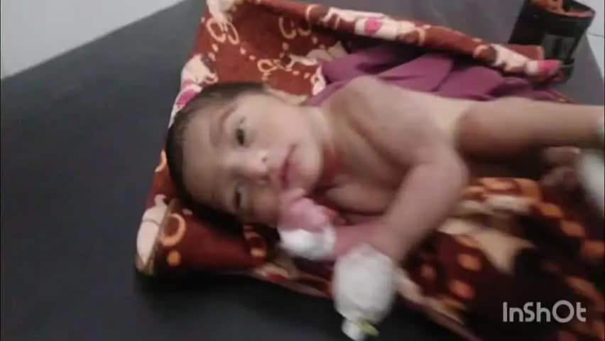 संभल: गंगावास के जंगल में झाड़ियों में मिला नवजात, आवारा कुत्ता उसे खींचकर ले जा रहा था, ग्रामीणों ने जिला अस्पताल भेजा