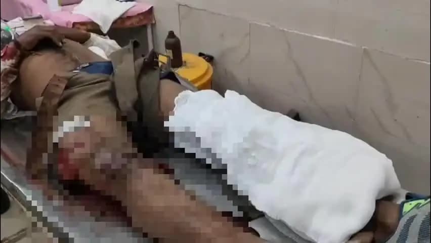 दमोह: हथनी के पास ट्रक की टक्कर से बाइक सवार गंभीर घायल, 108 एम्बुलेंस से जिला अस्पताल में भर्ती, ट्रक चालक फरार
