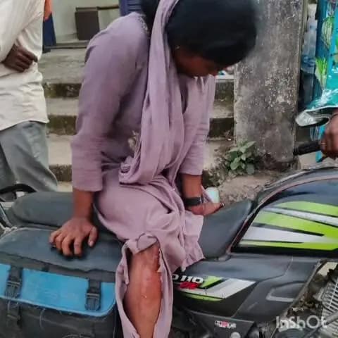 करतला: मड़वारानी पुल के पास बेकाबू ब्रेजा ने 7 से 8 लोगों को मारी टक्कर, महिला और बच्चे भी चपेट में आए