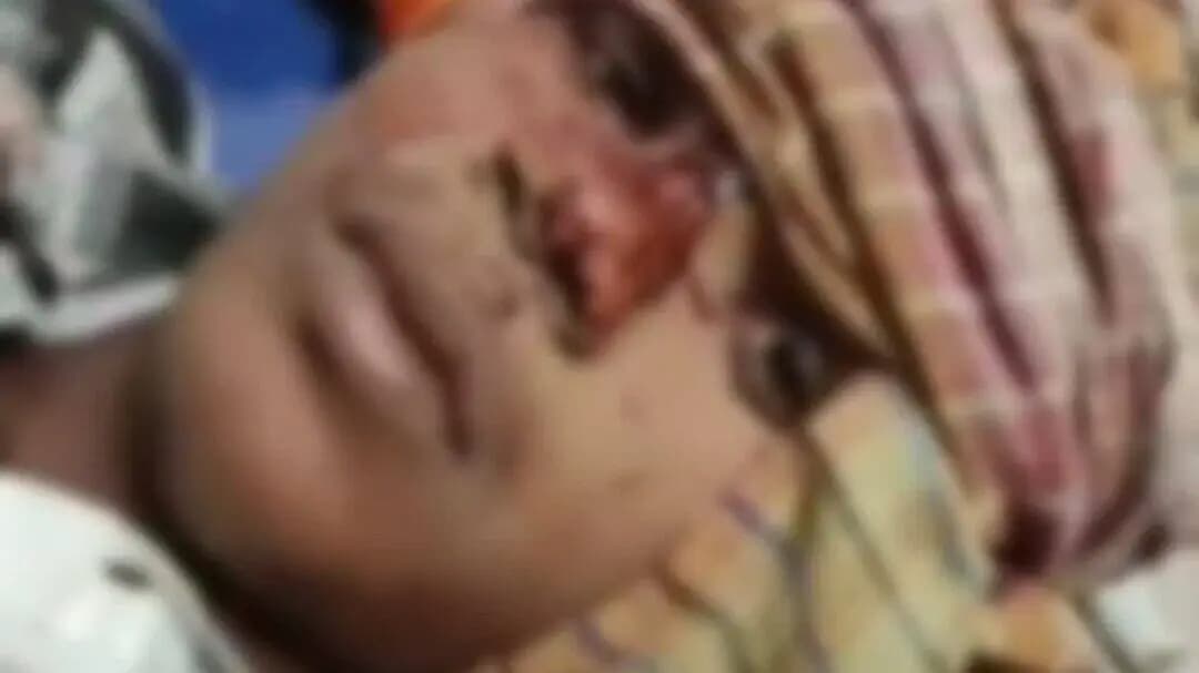 बेलागंज: डीहा मोड़ के पास अज्ञात वाहन की टक्कर से 2 बाइक सवार गंभीर घायल