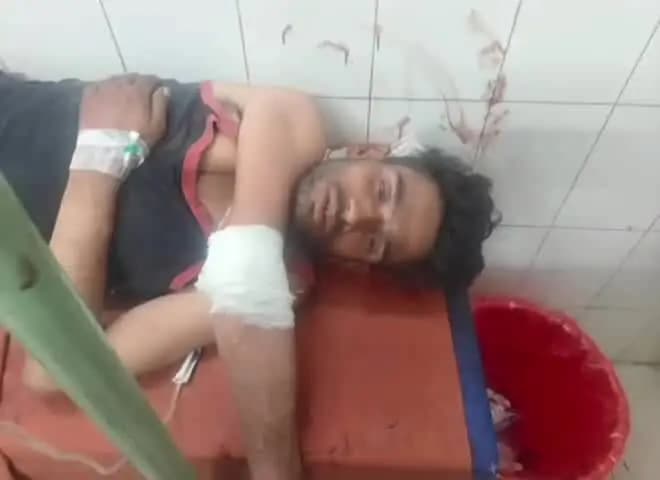ललितपुर: जाखलौन क्षेत्र में 2 सगे भाइयों के बीच विवाद, सरकारी पिस्टल से चली गोली, फरियादी घायल, 2 पुलिस कर्मी निलंबित
