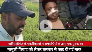 पकरीबरमा में एक व्यक्ति का नाक का*ट दिया गया मामूली विवाद को लेकर