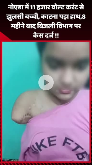 рдЧреМрддрдо рдмреБрджреНрдз рдирдЧрд░: рдиреЛрдПрдбрд╛ рдореЗрдВ 11 рд╣рдЬрд╛рд░ рд╡реЛрд▓реНрдЯ рдХрд░рдВрдЯ рд╕реЗ рдЭреБрд▓рд╕реА рдмрдЪреНрдЪреА, рд╣рд╛рде рдХрд╛рдЯрдирд╛ рдкрдбрд╝рд╛, 8 рдорд╣реАрдиреЗ рдмрд╛рдж рдмрд┐рдЬрд▓реА рд╡рд┐рднрд╛рдЧ рдкрд░ рджрд░реНрдЬ рд╣реБрдЖ рдХреЗрд╕