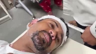 કરજણ: કરજન જલારામ નગરમા રહેતા બે ભાઈઓને ફળીયાના ઈસમોએ મારમારતા SSG મા સારવાર માટે ખસેડાયા