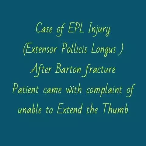 Tendon transfer at AIIMS BIBINAGAR For Post traumatic Thumb drop