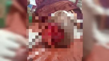 கீழக்கரை: திருப்புல்லாணி கோவிலுக்கு சென்று திரும்பிய கணவன் மனைவி விபத்தில் படுகாயம்