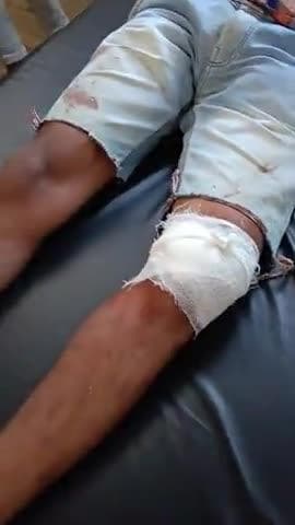 मे राकेश कुमार वर्मा मुझे कन्हैयालाल पिता मांगीलाल पुत्र अमित पत्नी संतोष बाई इन चारों ने कुल्हाड़ी ओर लाठी से मेरा पैर