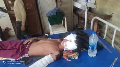 नारायणबगड़: नारायणबगड़ ब्लॉक के पैंतोली गांव में चारापत्ती लेने गए 10 वर्षीय बालक पर भालू ने किया हमला, हायर सेंटर रेफर