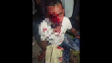 मरवन: मरवन में एसआरटी स्कूल के पास अज्ञात वाहन ने बाइक सवार को मारी टक्कर, बाइक सवार गंभीर रूप से घायल