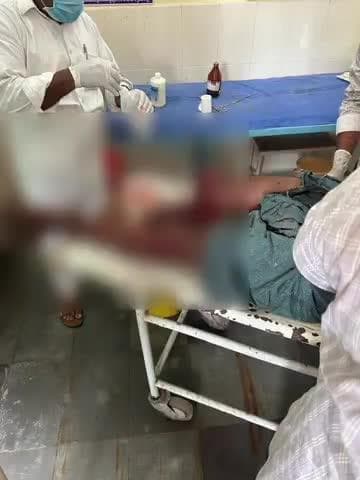 కోదాడ: శ్రీరంగాపురం జాతీయ రహదారిపై బైకు కారు డి వ్యక్తికి తీవ్ర గాయాలు... తెగిపడిన కాలు