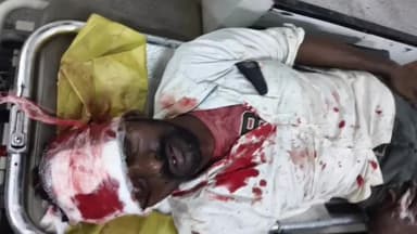 గాంధారి: ధర్మ కాంట వద్ద ఆగి ఉన్న ట్రక్కును ఢీకొని ఓ వ్యక్తికి తీవ్ర గాయాలు, ఆస్పత్రికి తరలింపు