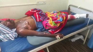 బీబీపేట: మండల కేంద్రంలో పెద్దమ్మ ఆలయం వద్ద వీధి దీపాలు పెడుతుండగా స్ట్రీట్ లైట్ వర్కర్ కు విద్యుత్ షాక్ తగిలి తీవ్ర గాయాలు