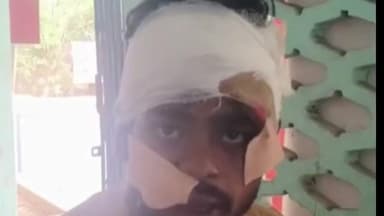 पीरपैंती: पीरपैंती थाना क्षेत्र में फोरलेन सड़क पर हुआ हादसा, दो मजदूर घायल
