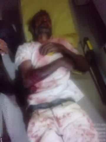 అల్లాదుర్గం: మధ్య మధ్యలో డబ్బుల కోసం గొడవ కొట్టుకున్న ఇద్దరు వ్యక్తులు గాయపడిన వ్యక్తి వైద్య చికిత్స పొందుతూమృతి అల్లాదుర్గం ci రేణుక