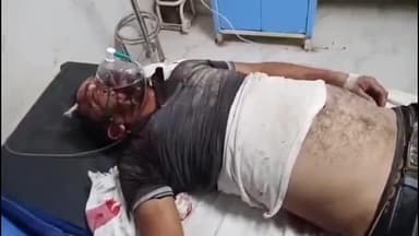 बसंतपुर: बसंतपुर थाना क्षेत्र के मदारपुर में सड़क दुर्घटना, एक व्यक्ति घायल, सिवान सदर अस्पताल में इलाज जारी