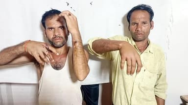 सीधी जिले के सेमरिया थाना क्षेत्र अंतर्गत ग्राम कठार में दो पक्षों में चले जमकर लाठी डंडे तीन लोग गंभीर
