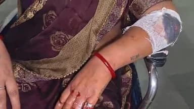 मानिकपुर: मानिकपुर से बाइक पर रामपुर जा रहे भाई-बहन जर्जर सड़क पर गिरकर बुरी तरह घायल, CHC में हुआ इलाज