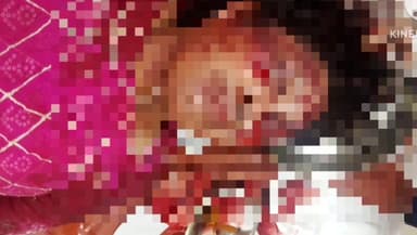 জিরানিয়া: নেশাগ্রস্ত দুই তরুনীর মারামারিতে একজন গুরুতর আহত অবস্থায় জিবি হাসপাতালে চিকিৎসাধীন,ঘটনা বোধজংনগর এলাকায়