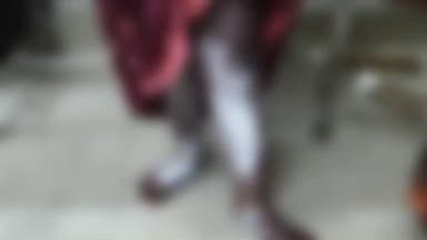 कोल: बन्नादेवी, गंधक-पोटाश ब्लास्ट में 4 लोग घायल, उपचार के दौरान एक युवक की दिल्ली में हुई मौत