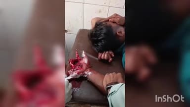 डूंगरपुर: आतिशबाजी के दौरान हाथ में फूटा बम, युवक गंभीर घायल, हाथ पर पहुंची गंभीर चोट
