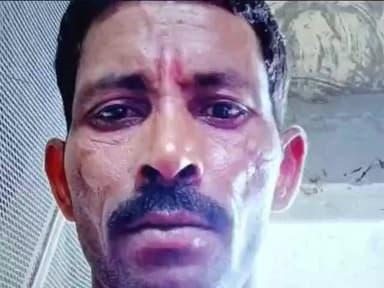 हसनपुर: सैदनगली में ट्रैक्टर की टक्कर से वेल्डिंग मिस्त्री हुआ घायल, उपचार के दौरान हुई मौत