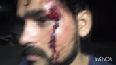 इगलास: इगलास गोरई थाना क्षेत्र के गांव जटवार में रास्ते के विवाद को लेकर दो पक्षों में जमकर लाठी-डंडे चले, हुआ पथराव