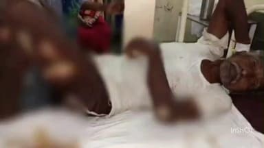 महासमुंद: भालू के झुंड ने पूजा करने वाले बैगा पर किया प्राणघातक हमला, घायल का अस्पताल में इलाज, स्थिति गंभीर