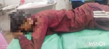 गुरूर: ग्राम श्यामतराई में मोटरसाइकिल अनियंत्रित होकर स्टापर से टकराई, युवक को गंभीर हालत में जिला अस्पताल लाया गया