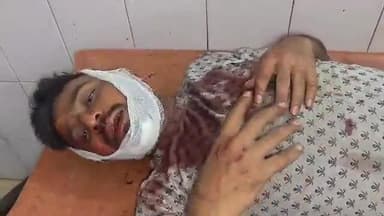 कर्वी: धारकुंडी से चित्रकूट की ओर जा रहे स्कूटी सवार काली घाटी में गिरकर घायल, CHC से जिला अस्पताल रेफर