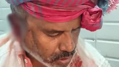 रायगढ़: नावापारा एसईसीएल प्रबंधन कार्यालय के पास कबाड़ का व्यवसाय करने वाले शख्स पर दो अज्ञात लोगों ने किया हमला