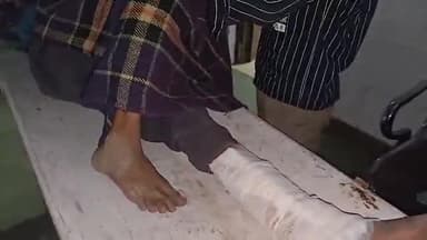 कर्वी: गढ़चपा जा रहे ई-रिक्शा को चार पहिया वाहन ने मारी टक्कर, रिक्शा चालक का पैर टूटा