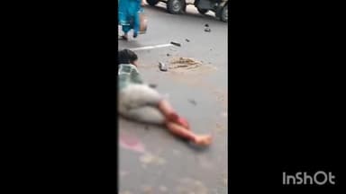 చిగురుమామిడి: చిన్న ముల్కనూర్ రోడ్డు ప్రమాదంలో ఆటో ఢీకొనడంతో నుజ్జునుజ్జు అయిన బాలుడి కాళ్లు, నొప్పి భరించ లేక కేకలు పెట్టిన బాబు