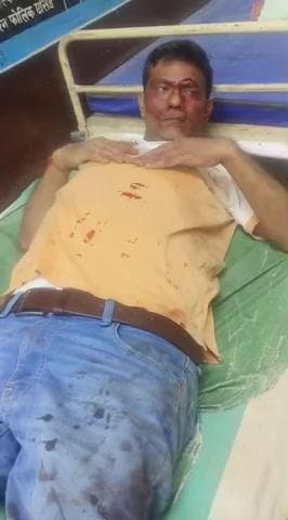 बदायूं: #बिसौली से तहसील पर रोड पर आमने-सम टकराई गाड़ी जिसमें प्रमोद सक्सेना के आई गंभीर रूप से चोट आई #up360 #update #news #up