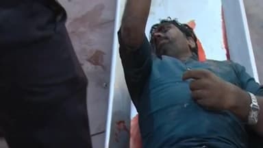 ಬಳ್ಳಾರಿ: ತಾಲೂಕಿನ ಅಸುಂಡಿ ಯುವಕನ ಸಾವು ಪ್ರಕರಣ: ಕೊಲೆ ಎಂದು ಸಾಬೀತು