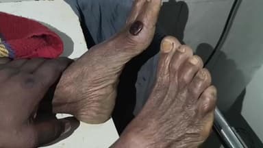 पेशरार: सांप काटने से महिला की मौत, परिजनों ने तांबे के सिक्के से जिंदा करने का किया प्रयास