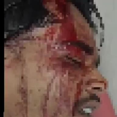 मुंगेली: लोरमी में गुपचुप बेचने वाले पर हुआ जानलेवा हमला, दो आरोपी गिरफ्तार, बाकी की तलाश जारी