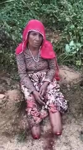 दुखद घटना - 😢 एक महिला (कमला देवी शीतोड) बामनवास के दोनों पैर काट दिए गए और पैरों से चांदी के आभूषण ले गए