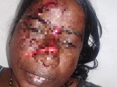 దుర్గి మండలం,ధర్మవరంలో భార్యపై గొడ్డలితో దాడి చేసిన భర్త