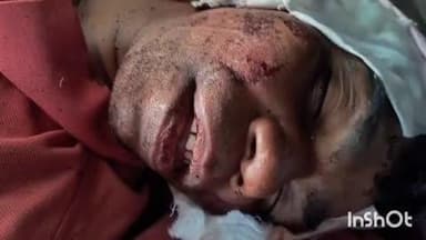 साकोली: साकोली पुलियावर अज्ञात वाहनाच्या धडकेत फोटोतील सदर व्यक्तीचा मृत्यू,ओळख पटवण्याचे साकोली पोलिसांचे आवाहन