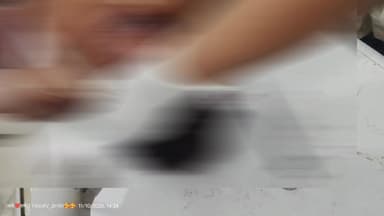 गिरिडीह: तीसरी थाना के तीसरी गांव का एक व्यक्ति सड़क हादसे में बुरी तरह घायल, अस्पताल से धनबाद रेफर