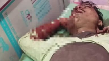 मेहनगर: कोहरौड़ा मोहम्मदपुर में अज्ञात वाहन की चपेट में आने से बाइक सवार युवक गंभीर रूप से घायल, अस्पताल में चल रहा इलाज