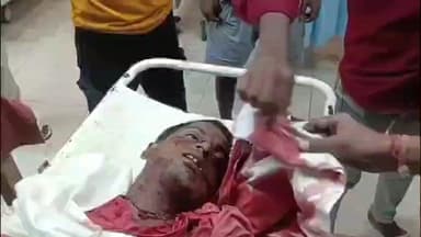 अलीनगर: विशनपुर थाना क्षेत्र में सड़क हादसा, पत्नी के सामने गाड़ी से कुचलकर युवक की मौत