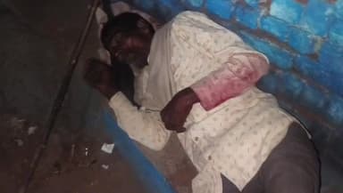 गोटेगांव: बगासपुर गांव में आवारा कुत्ते का आतंक, वृद्ध पर हमला, गांव में भय का माहौल