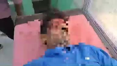 खड़गपुर: शिवपुर लौंगाय के पास अनियंत्रित ऑटो ने बाइक सवार को टक्कर मारी, पैर टूटे