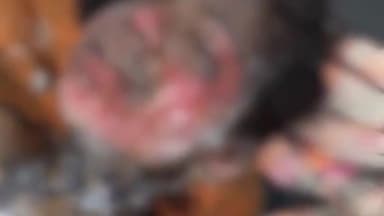 हाजीपुर: वैशाली: प्रेमी के इनकार पर युवती ने पेट्रोल छिड़ककर आग लगाई, इलाज के दौरान मौत