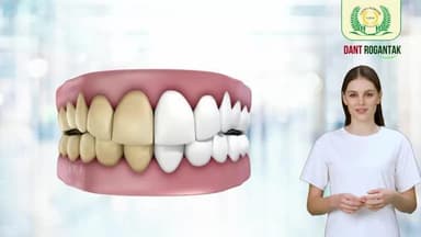 🌿 Dant Rogantak Toothpaste – आयुर्वेदिक विवरण, मुख्य उद्देश्य: दाँत और मसूड़ों के रोगों का प्राकृतिक इलाज एवं रोकथाम