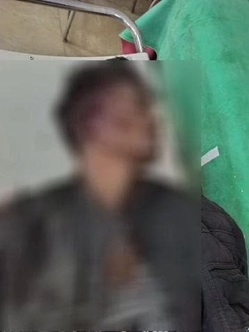 कवर्धा: ग्राम हरिनछपरा में तेज रफ्तार बाइक सवार 3 युवक अनियंत्रित होकर गिरे, एक युवक को आई गंभीर चोट, जिला अस्पताल में भर्ती