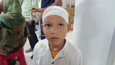 গাজোল: একটি শিশু বাচ্চা টিনের উপর পড়ে গিয়ে মাথা কেটে রক্তাক্ত হয়ে গুরুতর আহত হয়, গাজোল জামতলা গ্রাম এলাকার ঘটনা