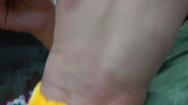 গাজোল: ভাইকে রেখে খেলায় মত্ত দিদি, জয়হাটে বিষ পিপঁড়ার কামড়ে অসুস্থ ৮ মাসের শিশু; নিয়ে আসা হল গাজোল স্টেট জেনারেল হাসপাতালে