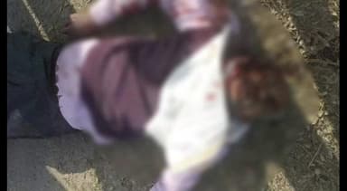 सूरजपुर: सूरजपुर की मुख्य मार्ग पर चंम्पाजोर के पास बाइक एक्सीडेंट में बाइक चालक को लगी चोट, इलाज जारी